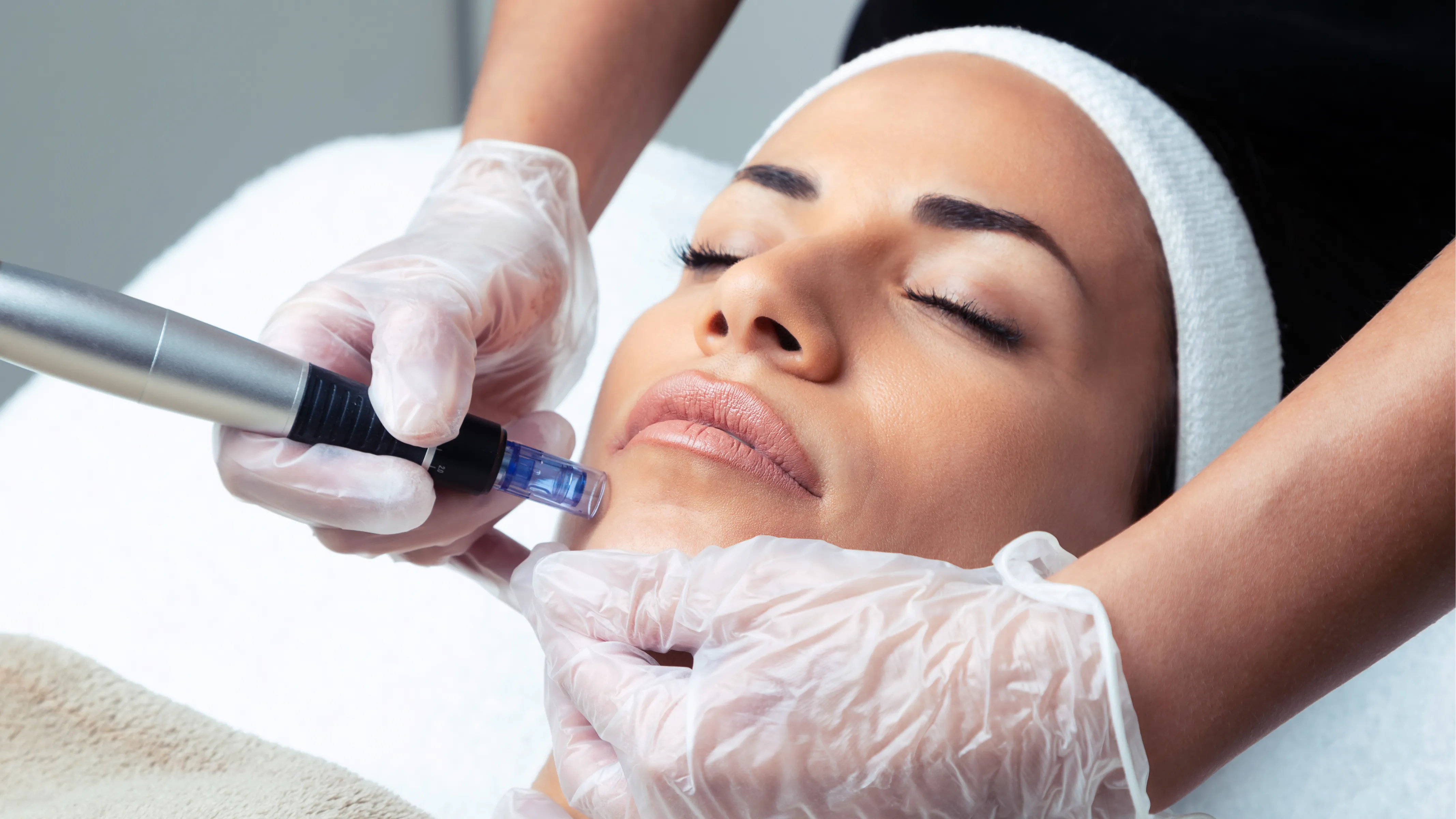 Microneedling Anti-Aging